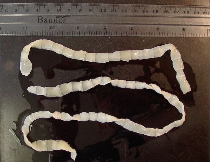 Tasiemiec żyjący w jelicie cienkim człowieka